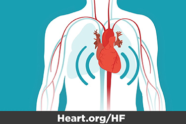 Thumbnail image for "Know the Symptoms of Heart Failure"