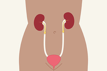 Thumbnail image for "Your Care at Home: Urostomy Care"