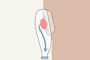 Thumbnail image for "Your Care at Home: Ileostomy Care"