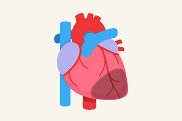 Thumbnail image for "Diagnosis and Treatment of a Heart Attack"