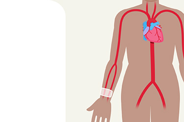 Thumbnail image for "When to Contact the Doctor: After Angioplasty "