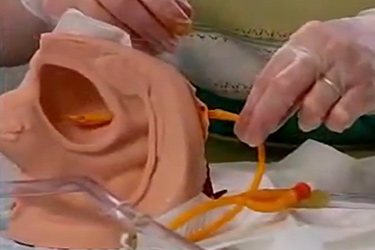 Thumbnail image for "Female Foley Catheter Application Demonstration"