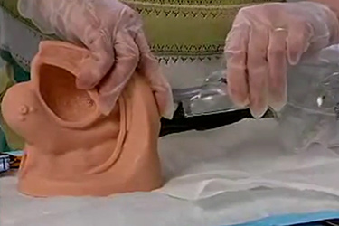 Thumbnail image for "Female Intermittent Catheterization Demonstration"