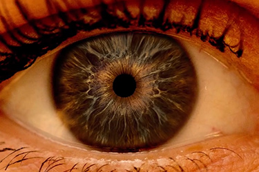 Thumbnail image for "Animation: Dilated Eye Exam"