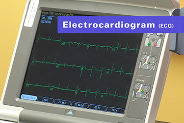 Thumbnail image for "What is an ECG?"
