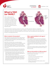 Thumbnail image for "What is TAVI (or TAVR)?"