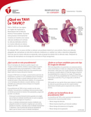 Thumbnail image for "¿Qué es TAVI (o TAVR)?"