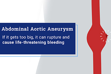 Thumbnail image for "Manejo del Aneurisma de Aorta Abdominal (AAA)"