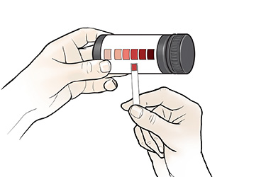 Thumbnail image for "Step-by-Step: Checking Ketones"