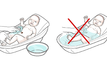 Thumbnail image for "Step-by-Step: Caring for Your Newborn's Umbilical Cord"