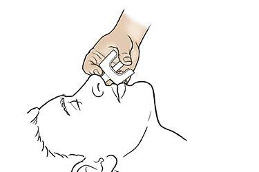 Thumbnail image for "Step-by-Step: Giving an Emergency Dose of Narcan for Opioid Overdose"