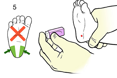 Thumbnail image for "Step-by-Step: Heelstick for a Baby"