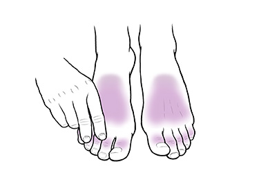 Thumbnail image for "Step-by-Step: Inspecting Your Feet (Diabetes)"