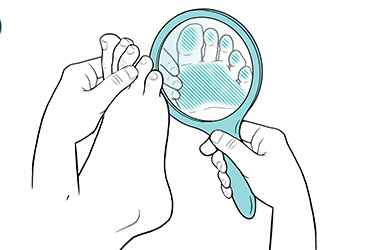 Thumbnail image for "Step-by-Step: Inspecting Your Feet When You Have Diabetes"