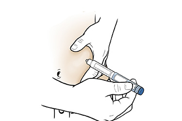 Thumbnail image for "Step-by-Step: Insulin Pen Injection with Clear Insulin"
