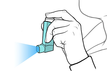 Thumbnail image for "Step by Step: Priming Your Metered-Dose Inhaler"