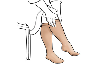 Thumbnail image for "Step-by-Step: Putting on Knee-High Compression Stockings"