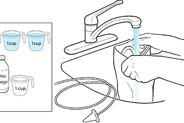 Thumbnail image for "Step-by-Step: Stoma Care: How to Irrigate"