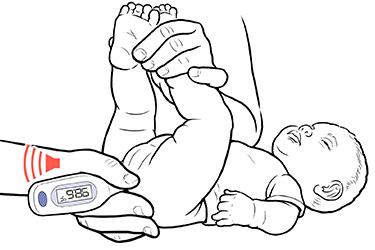 Thumbnail image for "Step-by-Step: Taking a Child's Rectal Temperature (0-3 Years of Age)"
