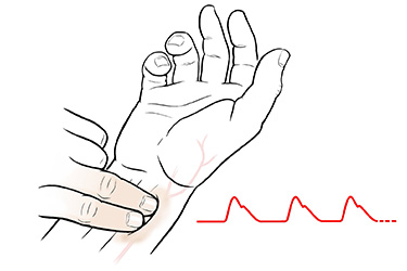 Thumbnail image for "Step-by-Step: Taking Your Pulse at Your Wrist"