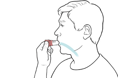 Thumbnail image for "Step-by-Step: Using a Dry-Powder Twist Inhaler"