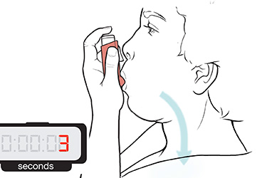 Thumbnail image for "Step-by-Step: Using a Steroid Inhaler"