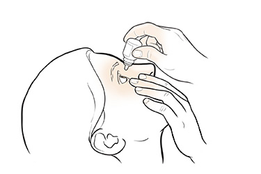 Thumbnail image for "Step-by-Step: Using Eye Drops"