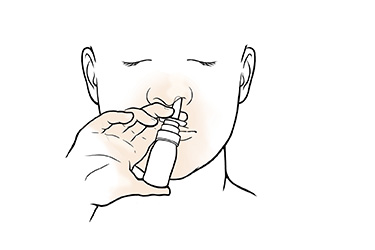 Thumbnail image for "Step-by-Step: Using Nasal Spray"