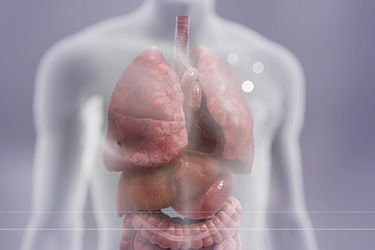 Thumbnail image for "Medical Animation: When Heart Failure Worsens"