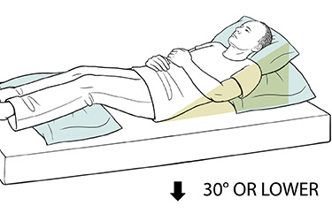Thumbnail image for "Step-by-Step: Helping a Person Move in Bed to Prevent Pressure Injuries"