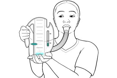 Thumbnail image for "Step by Step: Incentive Spirometry"