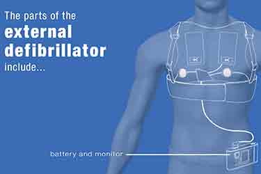 Thumbnail image for "What Is: External Defibrillator?"