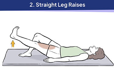 Thumbnail image for "Exercise Program for Meniscus Tear"