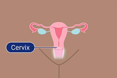 Thumbnail image for "5 Things to Know About Cervical Cancer Screening"