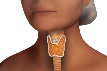 Thumbnail image for "Thyroidectomy: Before Surgery"