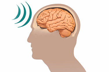 Thumbnail image for "Focus On: Closed Head Injury"
