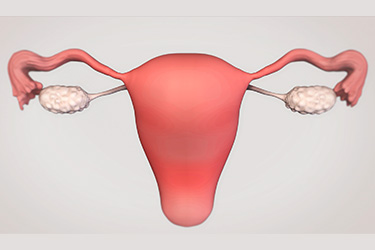 Thumbnail image for "Focus On: Uterine Fibroids"