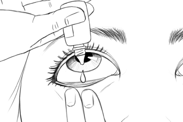 Thumbnail image for "Here's Help: How to Give Yourself Eyedrops or Eye Ointment"