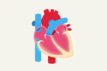 Thumbnail image for "What is Cardiac Catheterization?"