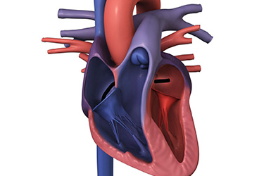 Thumbnail image for "Catheter Ablation for Atrial Fibrillation: Before Your Procedure"