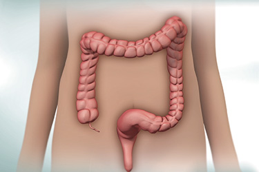 Thumbnail image for "Colonoscopy: Overview"