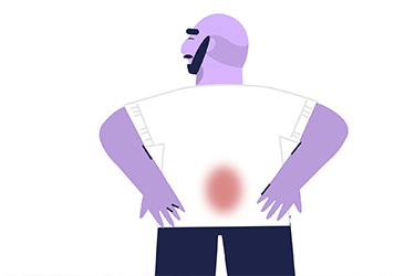 Thumbnail image for "Back Pain: What Is It?"