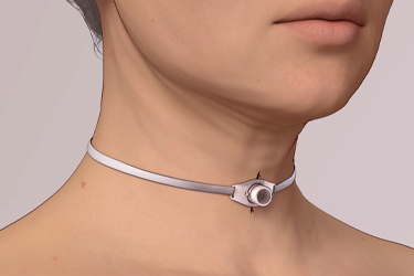 Thumbnail image for "Tracheostomy Surgery"