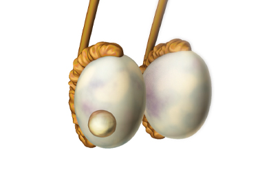 Thumbnail image for "Focus On: Testicular Cancer"