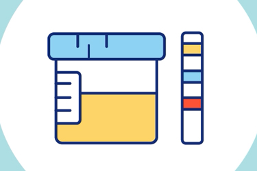 Thumbnail image for "Urine Test: Understanding the Test "