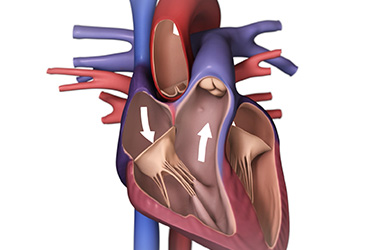 Thumbnail image for "Heart Failure: Fast Facts"