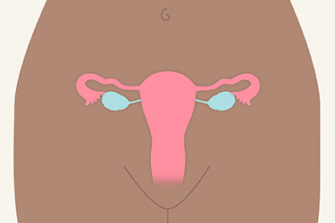 Thumbnail image for "Tubal Ligation and Salpingectomy"