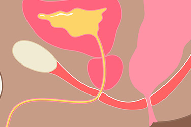 Thumbnail image for "Pelvic Floor Exercises for Men"