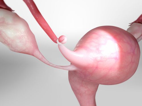 Tubal Reversal Testimonials | Pregnancy After Reversal | IVF Success Rates