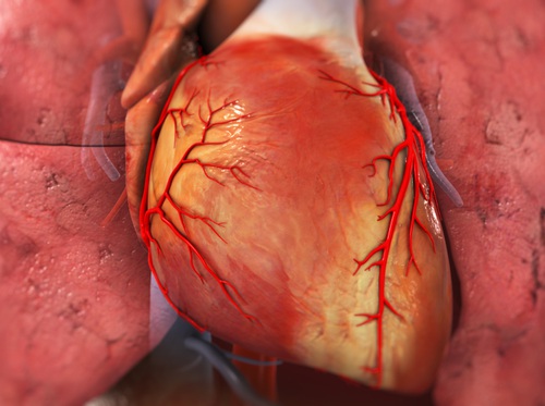 Thumbnail image for "Coronary Angiography"